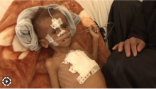  مأساة-حقوق-الإنسان - رئیس الوزراء الیمنی یتهم المملکة المتحدة بارتکاب جرائم حرب فی الیمن