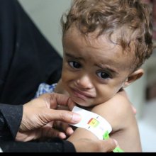  ������������������������������������������������������������������������-������������������������������������������������������������������������������������������������������������������������������ - الیونیسف: 1.4 ملیون طفل قد یموتون خلال العام الحالی بسبب الجوع