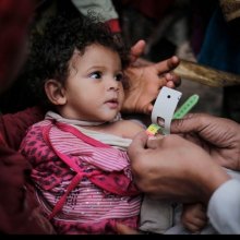  حقوق-الاطفال - المنظمة الدولیة للهجرة تدعم نظام الرعایة الصحیة فی الیمن لعلاج الکولیرا