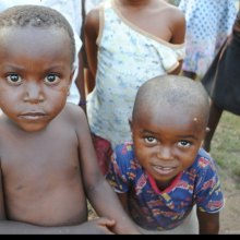 S-topComment-������������������������������������������������������������������������-�������������������������������������������� - الیونیسف: أزمة ملایین الأطفال فی البلدان الأربعة على شفا المجاعة لم تنته بعد