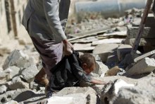 الأمین العام: إلحاح الأزمة الإنسانیة فی الیمن لا یترک مجالا للرضا عن الذات - yemen