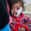  Yemen-UNICEF-vaccination-campaign-reaches-five-million-children - Children paying the heaviest price as conflict in Yemen enters third year – UN