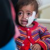  Senior-UN-officials-urge-concrete-action-to-end-Yemen-conflict-ease-‘appalling’-humanitarian-situation - Children paying the heaviest price as conflict in Yemen enters third year – UN