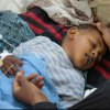  Half-of-all-health-facilities-in-war-torn-Yemen-now-closed-medicines-urgently-needed-–-UN - Cholera cases in Yemen may reach 130,000 in two weeks, UNICEF warns