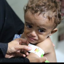  humanitarian-crisis - Yemen: UN, partners seek $2.1 billion to stave off famine in 2017