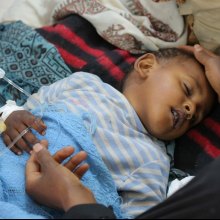  Malnutrition - Cholera cases in Yemen may reach 130,000 in two weeks, UNICEF warns