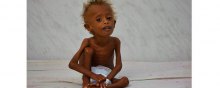 starvation - Saudi Arabia under spotlight over Khashoggi, but drastic Yemen crisis ignored