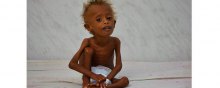  famine - Saudi Arabia under spotlight over Khashoggi, but drastic Yemen crisis ignored