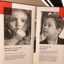 Sick Iranian Children’s Suffering Exhibition at the United Nations - E.B